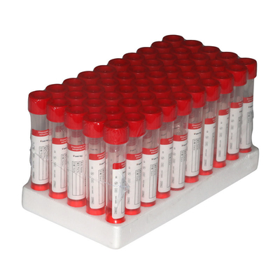 Palillo de nylon oral nasal VTM Kit Sterilization Packaging de la esponja