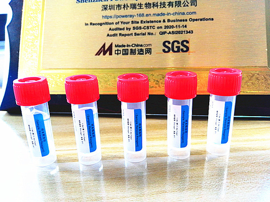 Extracción casera de la DNA y del ARN del equipo de la prueba de la polimerización en cadena de la aprobación del SGS para Covid-19